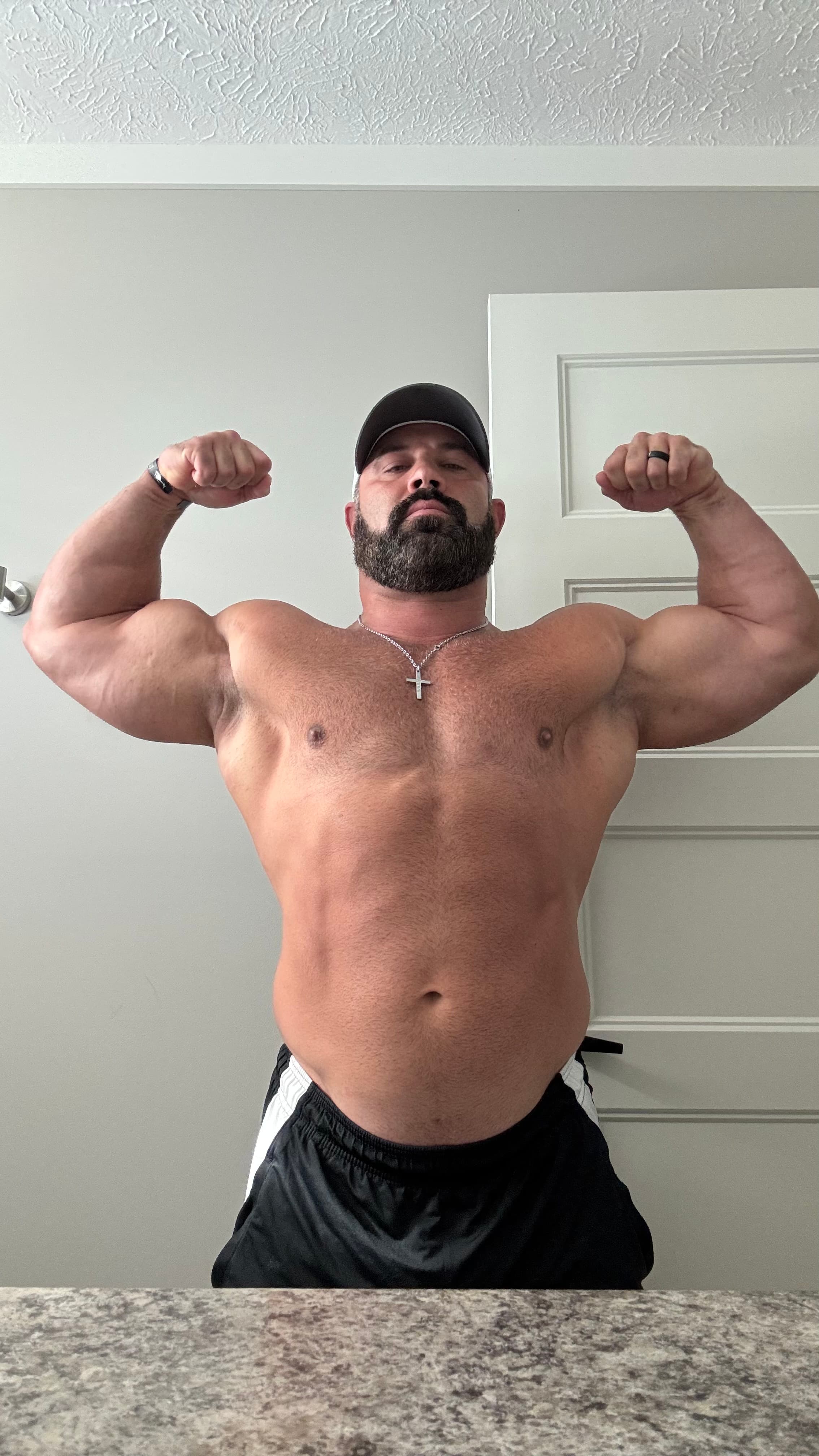 Client Transformation 3 — before photo